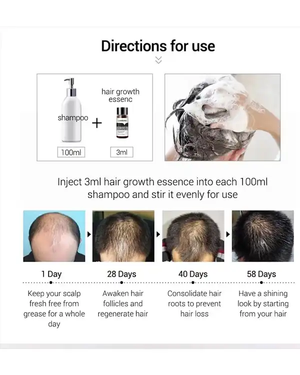 روغن تقویت کننده مو Lanbena مدل ESSENCE GROWTH