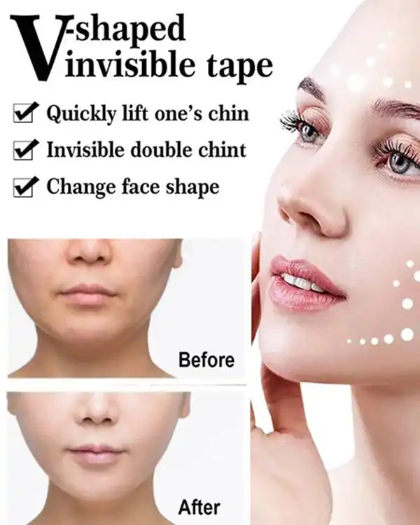 چسب اورژانسی اصلاح زاویه فک
