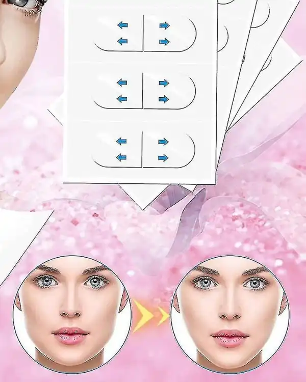 چسب اورژانسی اصلاح زاویه فک