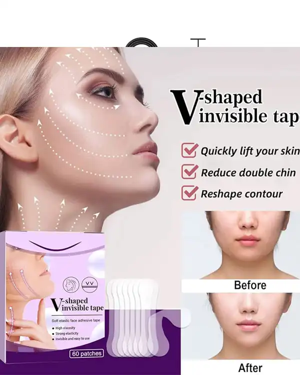 چسب اورژانسی اصلاح زاویه فک