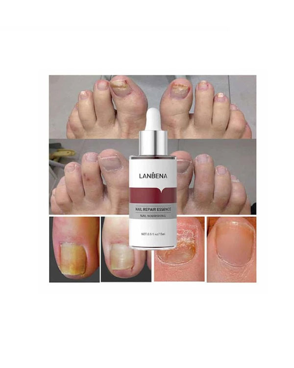 سرم تقویت کننده ناخن مدل LANBENA