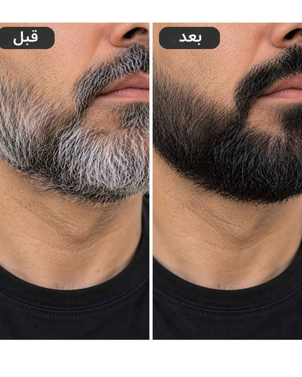 شامپو رنگ مو بابل موس ۵۰۰ میل (پک اورجینال تستردار)