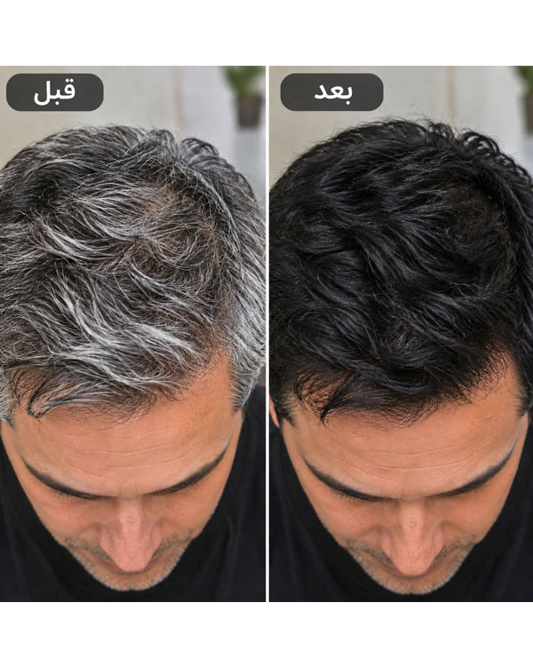شامپو رنگ مو بابل موس ۵۰۰ میل (پک اورجینال تستردار)