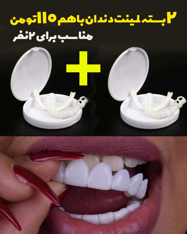2بسته لمینت دندان مدل Big smile (دوعددی)