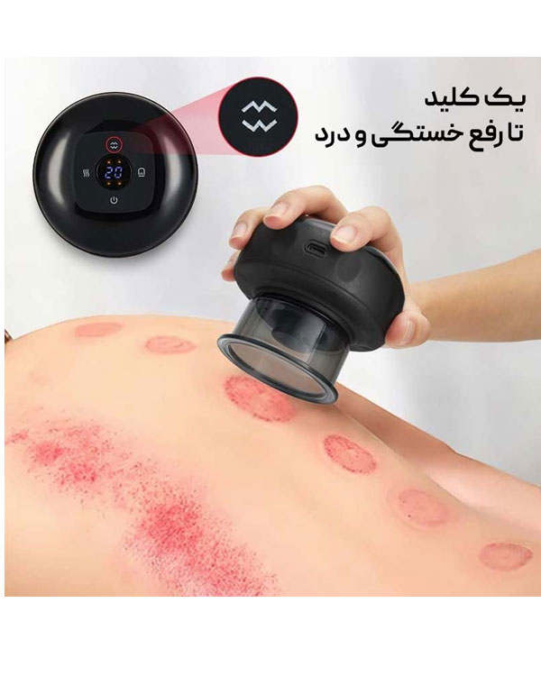 دستگاه بادکش برقی مدل 8545