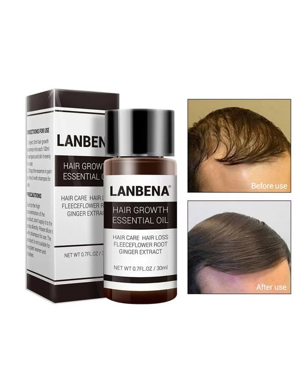 روغن رشد مو و ریش لانبنا LANBENA