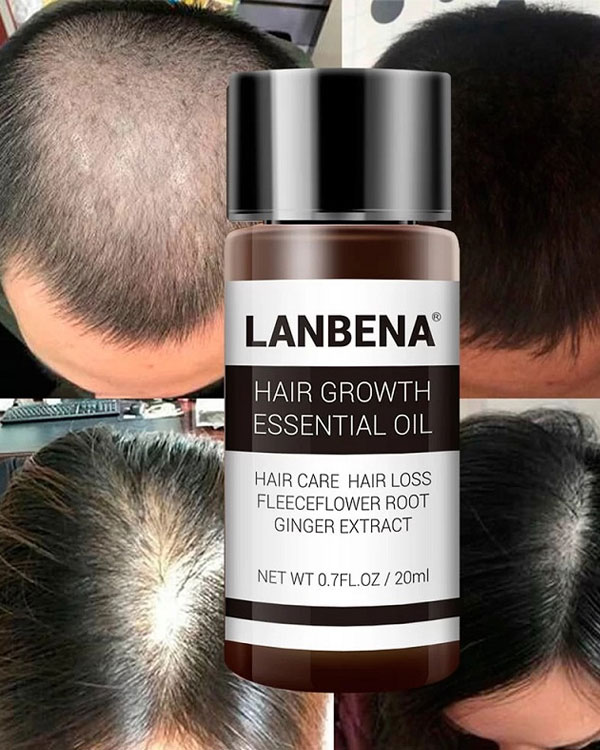 روغن رشد مو و ریش لانبنا LANBENA